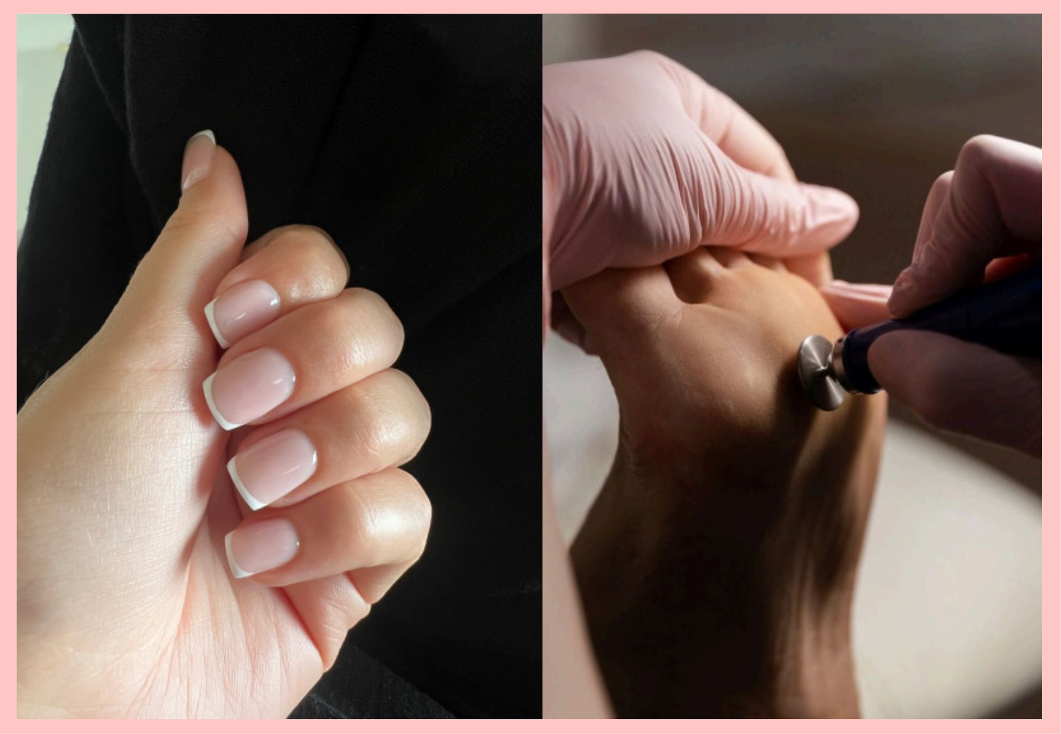 Photo examples de soins